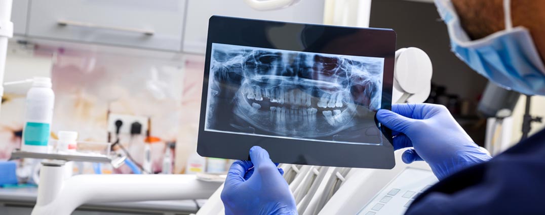 Chipped & Broken Tooth Repair