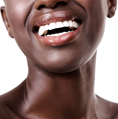 veneers that looks awesome